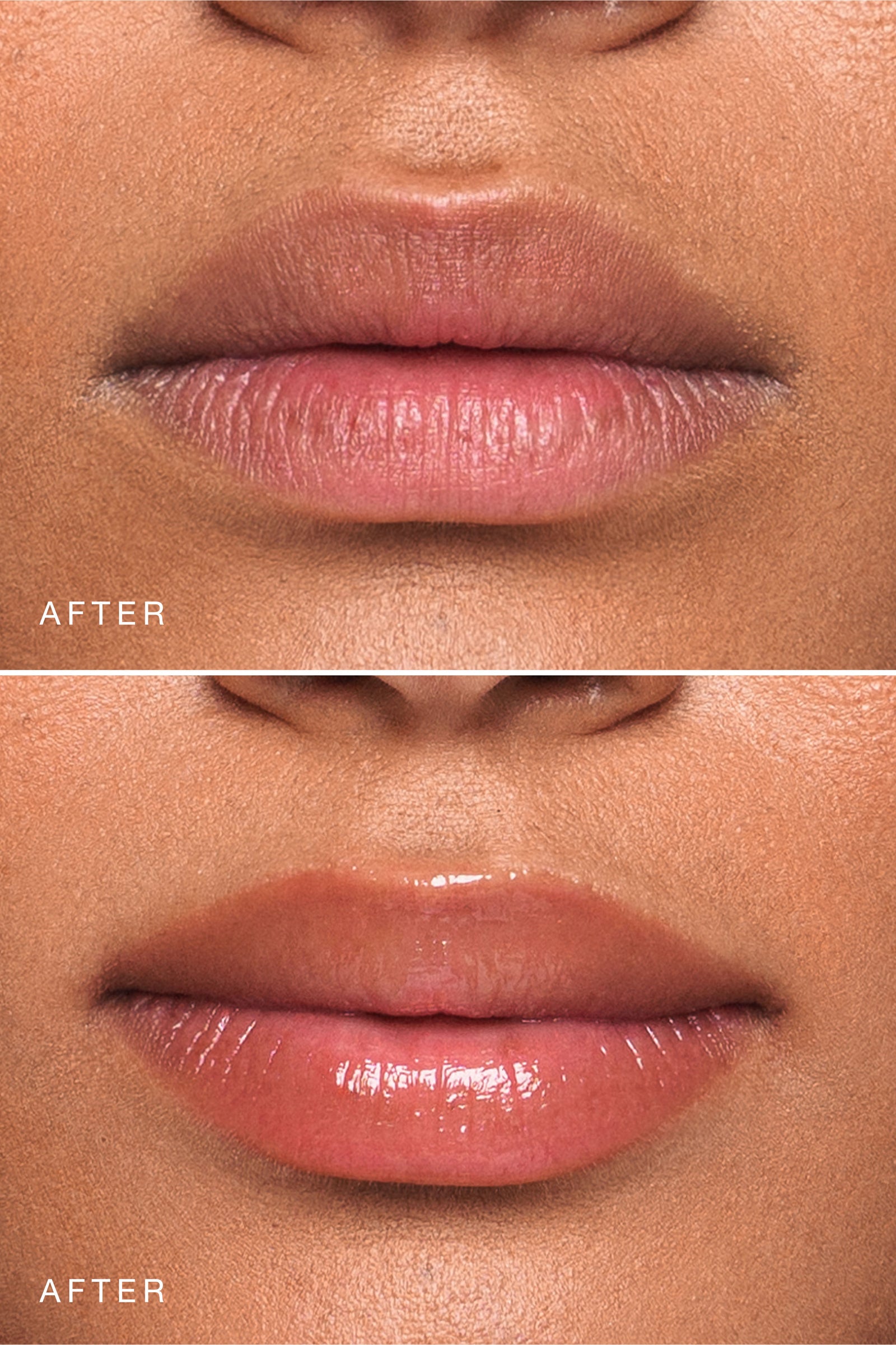 Rose Essential Lip Enhancer