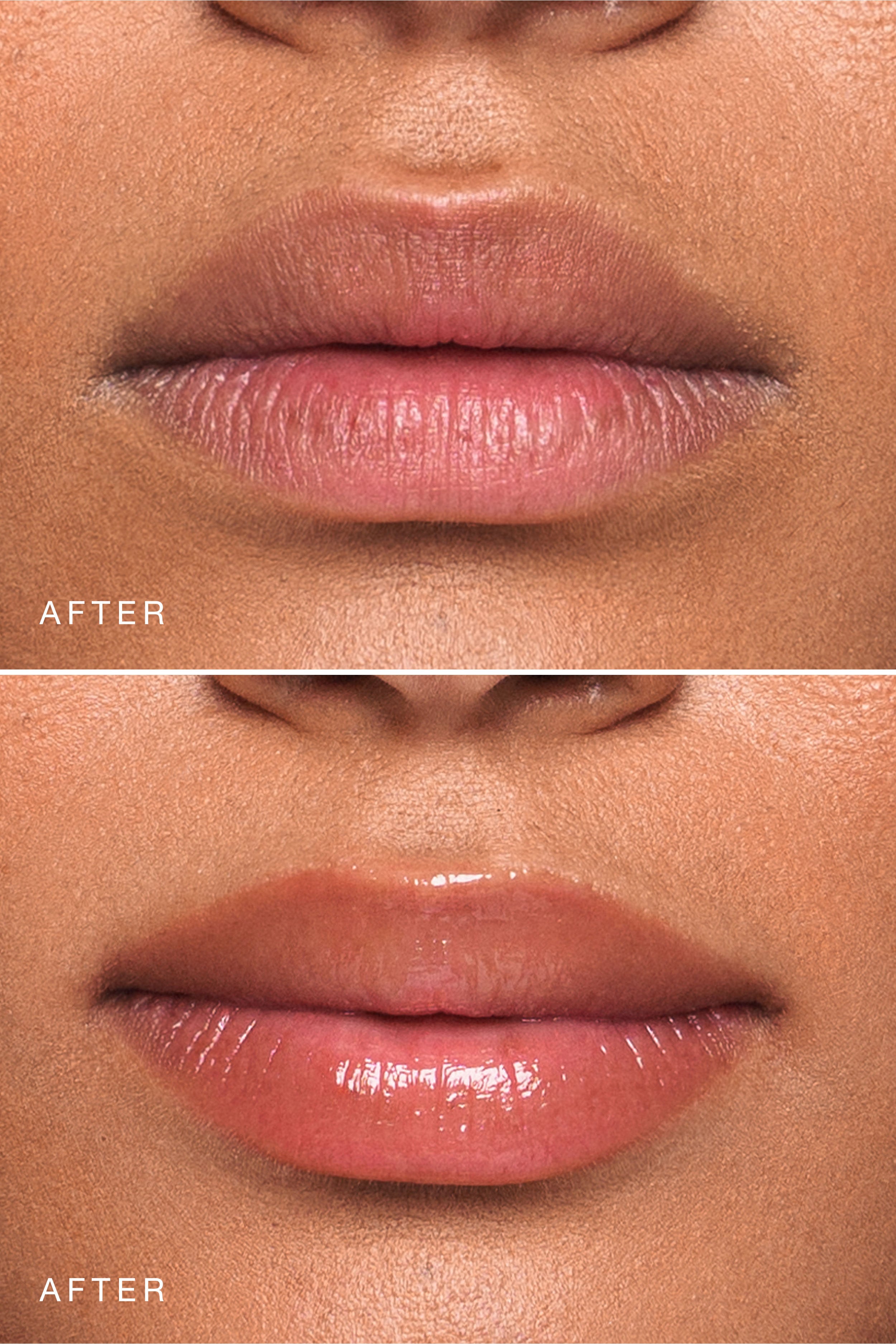 Rose Essential Lip Enhancer
